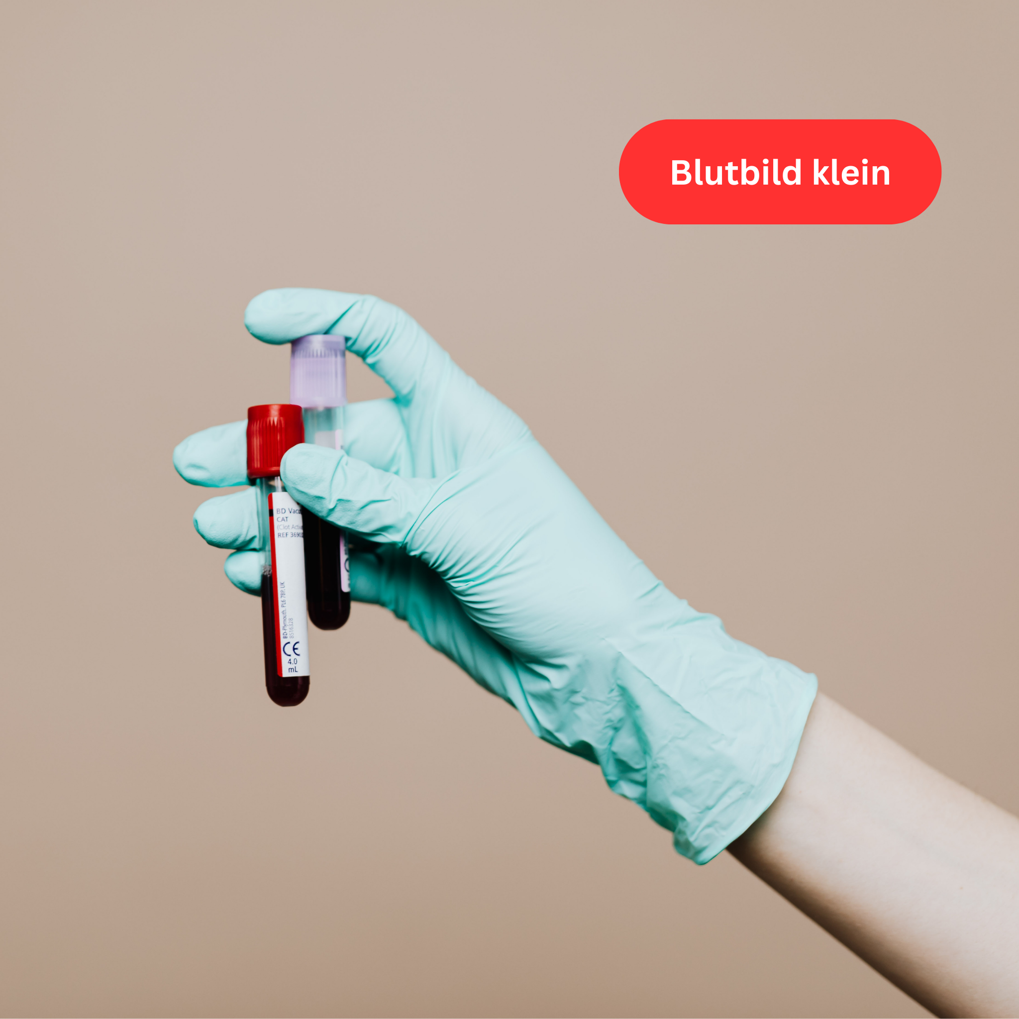 Blutbild klein - 30 Werte
